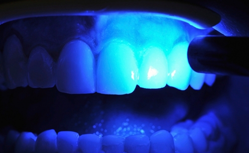 Family Dentist East Point GA 30344 | Gum Disease Is Ageless