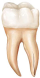 Family Dentist East Point GA 30344 | Root Fracture